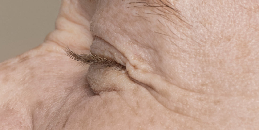 What Causes Skin Aging and How to Slow It Down
