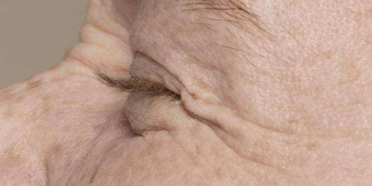 What Causes Skin Aging and How to Slow It Down